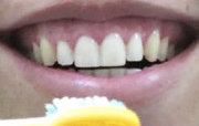 Escove os dentes da maneira certa